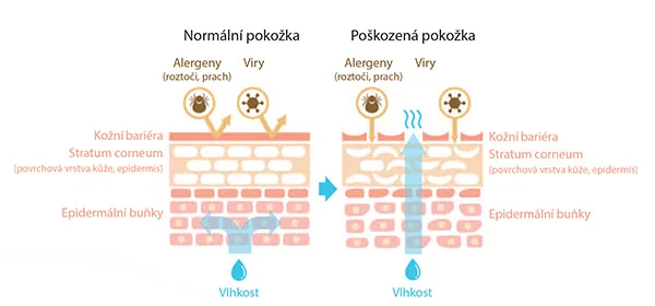 normalni poskozena pokozka img 600x280 1